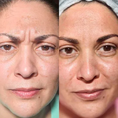 Resultados Reais do Jejum Metabólico