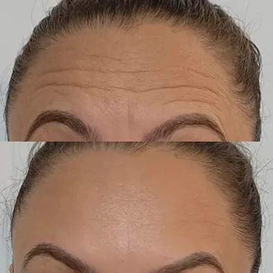 Resultados Reais do Jejum Metabólico