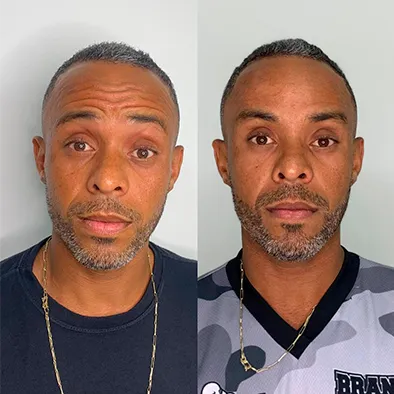 Resultados Reais do Jejum Metabólico